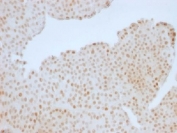 IHC testing of human colon with Rb antibody (clone RB1/1754). Required HIER: boil tissue sections in 10mM citrate buffer, pH 6, for 10-20 min followed by cooling at RT for 20 min.