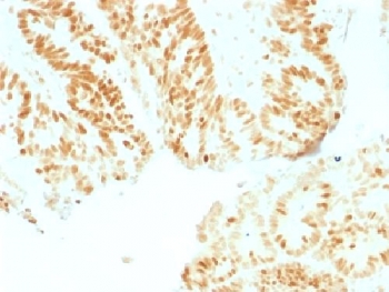 IHC testing of human colon with Rb antibody (clone RB1/1754). Required HIER: boil tissue sections in 10mM citrate buffer, pH 6, for 10-20 min followed by cooling at RT for 20 min.~