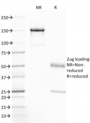 SDS-PAGE Analysis of Purified, BSA-Free CFTR Antibody (clone CFTR/1785). Confirmation of Integrity and Purity of the Antibody.