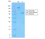 SDS-PAGE analysis of purified, BSA-free recombinant CFTR antibody (clone CFTR/1775R) as confirmation of integrity and purity.