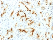 IHC testing of FFPE human pancreas with recombinant CFTR antibody (clone CFTR/1775R). HIER: boil tissue sections in 10mM Tris with 1mM EDTA, pH9 for 10-20 min followed by cooling at RT for 20 min.