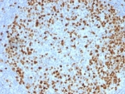 IHC testing of FFPE human tonsil with TOP2A antibody (clone TOP2A/1362). Required HIER: boil sections in pH 9 10mM Tris with 1mM EDTA for 10-20 min followed by cooling at RT for 20 min.
