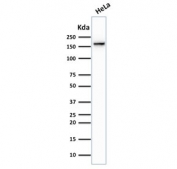 Western blot testing of human HeLa cell lysate with TOP2A antibody (clone TOP2A/1362). Expected molecular weight ~174 kDa.