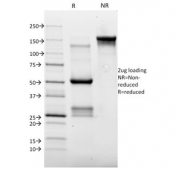 SDS-PAGE analysis of purified, BSA-free TOP2A antibody (clone TOP2A/1362) as confirmation of integrity and purity.