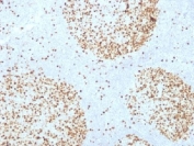 IHC testing of FFPE human tonsil with Topoisomerase II alpha antibody (clone TOP2A/1361). Required HIER: boil sections in pH 9 10mM Tris with 1mM EDTA for 10-20 min followed by cooling at RT for 20 min.