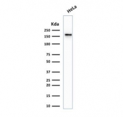 Western blot testing of human HeLa cell lysate with Topoisomerase II alpha antibody (clone TOP2A/1361). Expected molecular weight ~174 kDa.