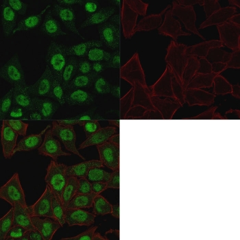 Immunofluorescent staining of PFA-fixed human HeLa cells with Topoisomerase II alpha antibody (green, clone TOP2A/1361) and Phalloidin (red).