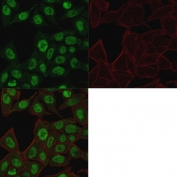 Immunofluorescent staining of PFA-fixed human HeLa cells with Topoisomerase II alpha antibody (green, clone TOP2A/1361) and Phalloidin (red).