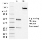 SDS-PAGE Analysis of Purified, BSA-Free TSHR Antibody (clone TSHRA/1405). Confirmation of Integrity and Purity of the Antibody.