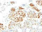 IHC testing of FFPE human small intestine with DC-SIGN antibody (clone C209/1781). Required HIER: boil tissue sections in 10mM Tris with 1mM EDTA, pH 9, for 10-20.