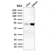 Western blot testing of human liver and spleen lysate with DC-SIGN antibody. Predicted molecular weight ~46 kDa.
