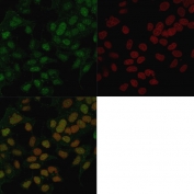 Immunofluorescent staining of PFA-fixed human MCF7 cells with FOXA1 antibody (clone FOXA1/1241, green) and Reddot (red).
