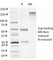 SDS-PAGE Analysis of Purified, BSA-Free FOXA1 Antibody (clone FOXA1/1241). Confirmation of Integrity and Purity of the Antibody.