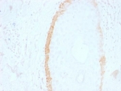 IHC testing of FFPE human skin with Cytokeratin 15 antibody (clone SPM190). Required HIER: boil tissue sections in pH 9 10mM Tris with 1mM EDTA for 10-20 min.