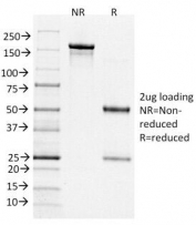 SDS-PAGE Analysis of Purified, BSA-Free Bcl6 Antibody (clone BCL6/1526). Confirmation of Integrity and Purity of the Antibody.
