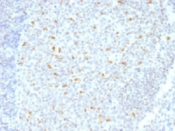 IHC testing of FFPE human tonsil tissue with Bcl6 antibody (clone BCL6/1526). Required HIER: boil tissue sections in 10mM Tris with 1mM EDTA, pH 9, for 10-20 min.~