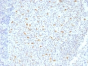 IHC testing of FFPE human tonsil tissue with Bcl6 antibody (clone BCL6/1526). Required HIER: boil tissue sections in 10mM Tris with 1mM EDTA, pH 9, for 10-20 min.
