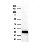 Western blot testing of human thymus lysate with CD3e antibody (clone PC3/188A). Expected molecular weight ~23 kDa. 