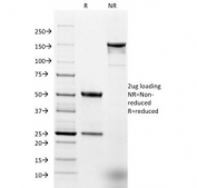 SDS-PAGE analysis of purified, BSA-free Ep-CAM antibody (clone EGP40/1798) as confirmation of integrity and purity.