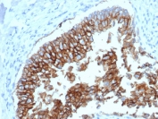 IHC testing of FFPE dog bladder and Ep-CAM antibody (clone EGP40/1798). Required HIER: steam sections in pH6 citrate buffer for 10-20 min.