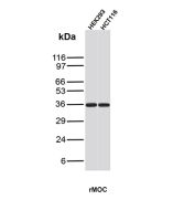 EpCAM Antibody HEK293 & HCT116 WB. Western blot analysis of HEK293 and HCT116 cell lysates using EpCAM Antibody (clone rMOC-31) demonstrates a strong immunoreactive band at approximately 36-40 kDa in both cell lines. The observed molecular weight is consistent with Epithelial Cell Adhesion Molecule (EpCAM/CD326), a heavily glycosylated transmembrane glycoprotein involved in epithelial cell adhesion, tissue organization, and cellular signaling. The slight increase in apparent molecular weight relative to the predicted protein size is consistent with known glycosylation of EpCAM. Detection in both HEK293 and HCT116 cells is consistent with the established expression of EpCAM in epithelial-derived cell populations and supports the specificity of the antibody for recognition of EpCAM protein.