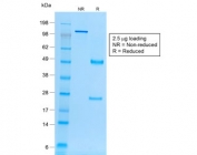 SDS-PAGE analysis of purified, BSA-free recombinant Ep-CAM antibody (clone rVU-1D9) as confirmation of integrity and purity.