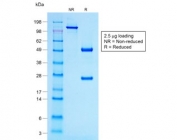 SDS-PAGE analysis of purified, BSA-free recombinant ACTH antibody (clone r57) as confirmation of integrity and purity.
