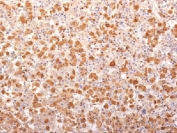 IHC testing of FFPE human pituitary gland with recombinant ACTH antibody (clone r57). Required HIER: boil tissue sections in 10mM citrate buffer, pH 6, for 10-20 min followed by cooling at RT for 20 min.