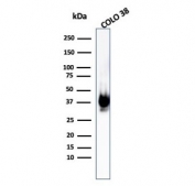 Western blot testing of human COLO-38 cell lysate with recombinant gp100 antibody (clone PMEL/1825R).