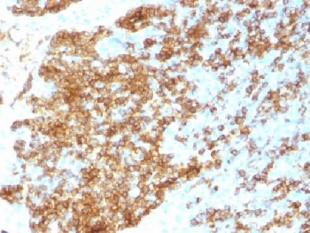 IHC testing of recombinant CD45RB antibody and FFPE human tonsil (clone PTPRC/1783R). Required HIER: boil tissue sections in 10mM citrate buffer, pH 6, for 10-20 min followed by cooling at RT for 20 min.~