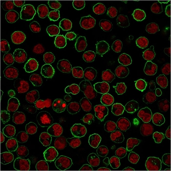 Immunofluorescence staining of PFA-fixed human Raji cells with CD45RB antibody (clone PTPRC/1783R, green) and Phalloidin (red).