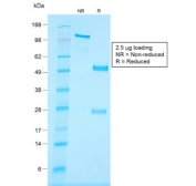 SDS-PAGE analysis of purified, BSA-free recombinant CD34 antibody (clone HPCA1/1806R) as confirmation of integrity and purity.