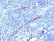 IHC testing of FFPE human tonsil with recombinant CD34 antibody (clone HPCA1/1806R). Required HIER: boil tissue sections in 10mM Tris with 1mM EDTA, pH 9, for 10-20 min followed by cooling at RT for 20 min.