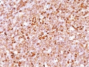 IHC testing of FFPE human tonsil with recombinant CD79a antibody (clone IGA/1688R). Required HIER: boil tissue sections pH 9 10mM Tris with 1mM EDTA, for 10-20 min followed by cooling at RT for 20 min.