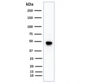 Western blot testing of human Raji cell lysate with recombinant CD79a antibody (clone IGA/1688R). Expected molecular weight: 25-47 kDa depending on glycosylation level.