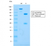 SDS-PAGE analysis of purified, BSA-free recombinant CD79a antibody (clone IGA/1688R) as confirmation of integrity and purity.