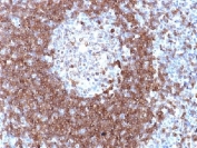 IHC testing of FFPE human tonsil with CD79a antibody. Required HIER: boil tissue sections in pH 9 10mM Tris with 1mM EDTA for 10-20 min followed by cooling at RT for 20 min.