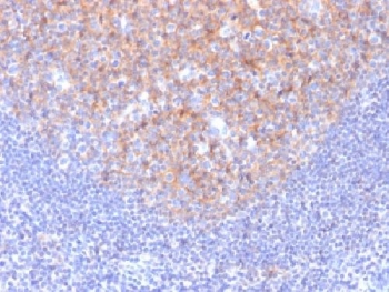IHC testing of FFPE human tonsil with CD81 antibody (clone 1.3.3.22). Required HIER: boil tissue sections in 10mM citrate buffer, pH 6, for 10-20 min followed by cooling at RT for 20 min.~