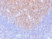 IHC testing of FFPE human tonsil with CD81 antibody (clone 1.3.3.22). Required HIER: boil tissue sections in 10mM citrate buffer, pH 6, for 10-20 min followed by cooling at RT for 20 min.
