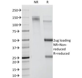 SDS-PAGE Analysis of Purified, BSA-Free CDw78 Antibody (clone DF1588). Confirmation of Integrity and Purity of the Antibody.