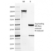 SDS-PAGE analysis of purified, BSA-free HPV-16 E6 antibody (clone HPV16/1296) as confirmation of integrity and purity.