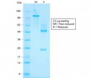 SDS-PAGE analysis of purified, BSA-free recombinant Basic Cytokeratin antibody (clone KRTH/1576R) as confirmation of integrity and purity.