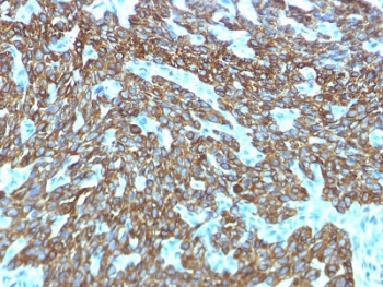 IHC testing of FFPE human skin with recombinant Basic Cytokeratin antibody (clone KRTH/1576R). Required HIER: boil tissue sections in 10mM citrate buffer, pH 6, for 10-20 min followed by cooling at RT for 20 min.~