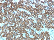 IHC testing of FFPE human skin with recombinant Basic Cytokeratin antibody (clone KRTH/1576R). Required HIER: boil tissue sections in 10mM citrate buffer, pH 6, for 10-20 min followed by cooling at RT for 20 min.