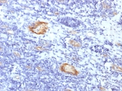 IHC testing of FFPE human tonsil with recombinant vWF antibody (clone VWF/1859R). Required HIER: boil tissue sections in pH 9 10mM Tris with 1mM EDTA for 10-20 min followed by cooling at RT for 20 min.