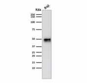 Western blot testing of human Raji cell lysate with recombinant CD79a antibody (clone IGA/1790R). Expected molecular weight: 25-47 kDa depending on glycosylation level.