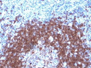 IHC testing of FFPE human tonsil with recombinant CD79a antibody (clone IGA/1790R). Required HIER: boil tissue sections in pH 9 10mM Tris with 1mM EDTA for 10-20 min followed by cooling at RT for 20 min.~