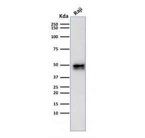 Western blot testing of human Raji cell lysate with recombinant CD79a antibody (clone IGA/1790R). Expected molecular weight: 25-47 kDa depending on glycosylation level.