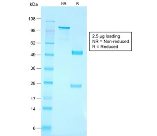 SDS-PAGE analysis of purified, BSA-free recombinant CD79a antibody (clone IGA/1790R) as confirmation of integrity and purity.