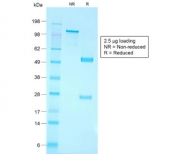 SDS-PAGE analysis of purified, BSA-free recombinant CD79a antibody (clone IGA/1790R) as confirmation of integrity and purity.